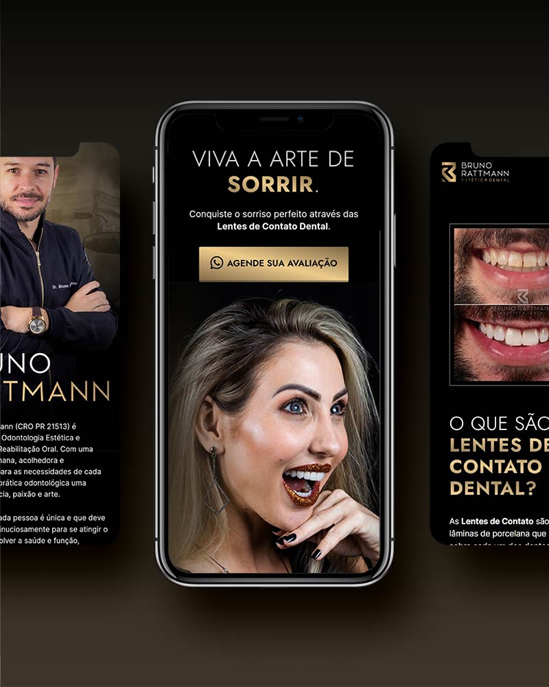 Dr. Bruno Rattmann: Lentes de Contato Dental, Curitiba - PR. Branding, Webdesign, Assessoria de Marketing Digital.