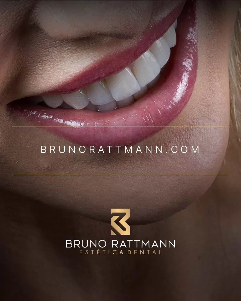 Dr. Bruno Rattmann: Lentes de Contato Dental, Curitiba - PR. Branding, Webdesign, Assessoria de Marketing Digital.